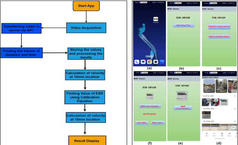 ESR App API CV (Erythrocyte Sedimentation Rate Estimation)